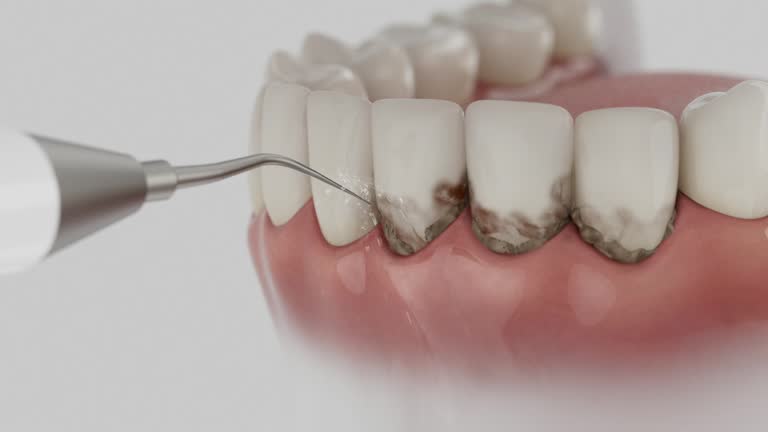 Trusted Emergency Dentist service in West Frankfort, IL - Dentist Open Now